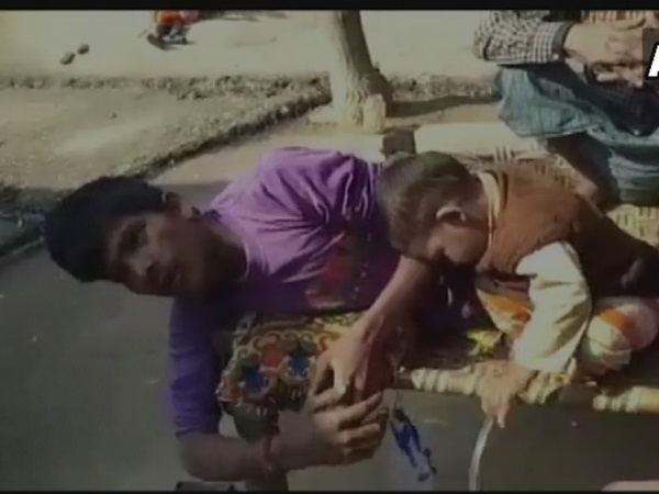 पति के इलाज के लिए बेचा जिगर के टुकड़े को 