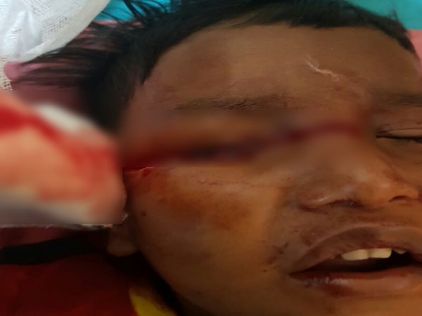 अंकल के साथ गाड़ी में बैठकर जा रहा था बच्चा