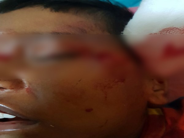 काले वाड़ी इलाके का मामला