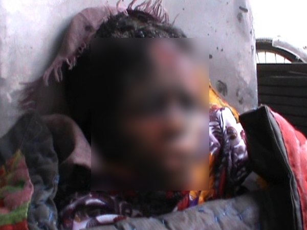 महिला स्थिति गंभीर बनी हुई है