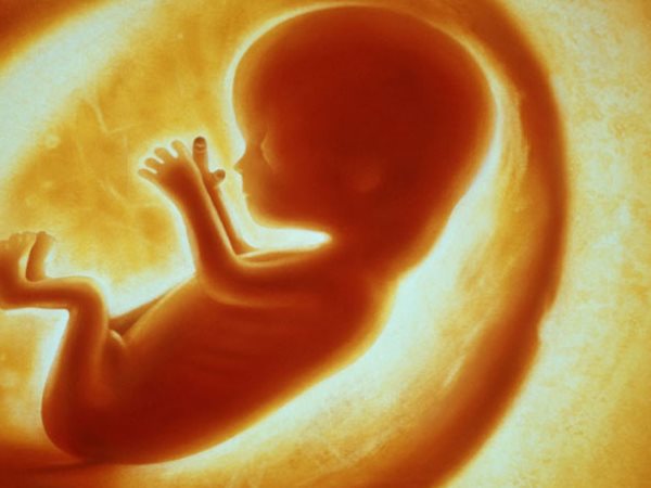 पुलिस ने जाल बिछाकर आरोपियों को दबोचा