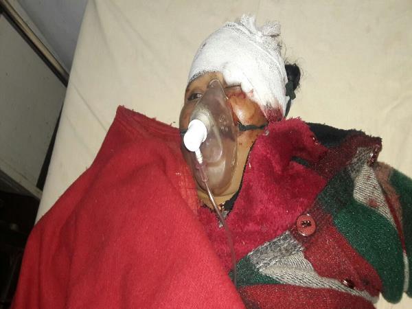 six people including five women died in road accident in mathura