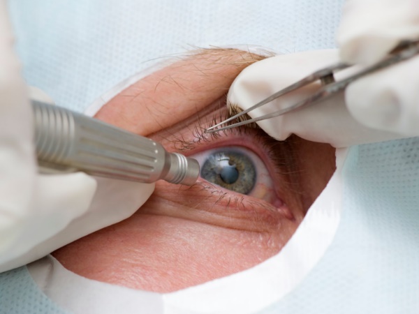 आंखों से निकाले गए 14 वॉर्म