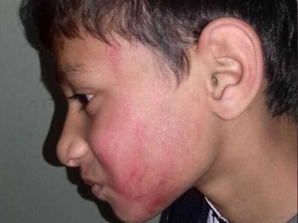 डांस टीचर ने बुरी तरह पीटा