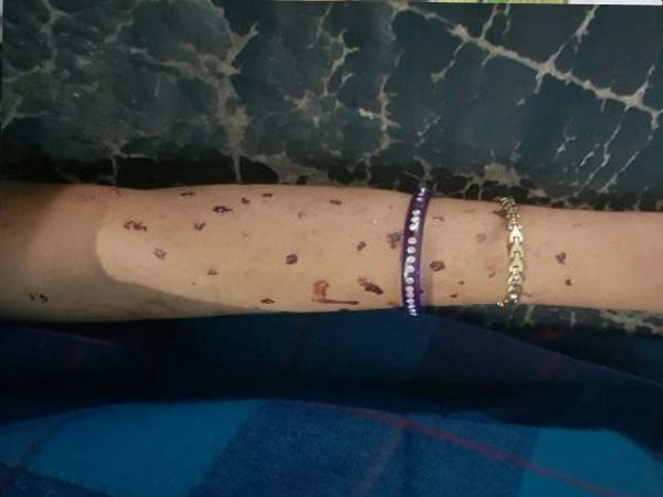 पूरे शरीर से निकल रहा था खून