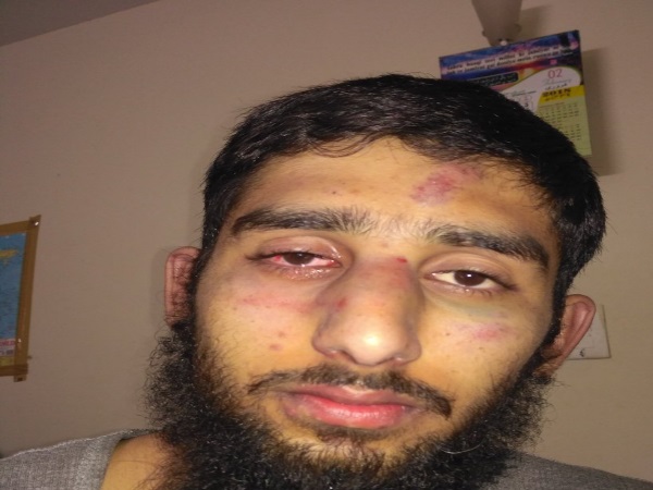 'कश्मीरी छात्रों की पिटाई खबर सुनकर बेहद सदमे में हूं'