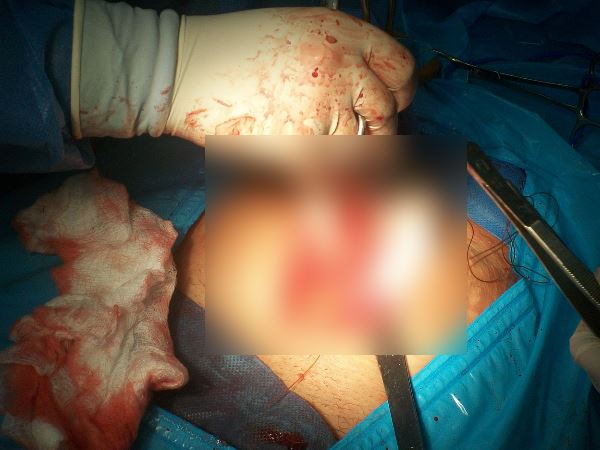 भागकर पहुंचे गांव, बरस पड़े डॉक्टर पर