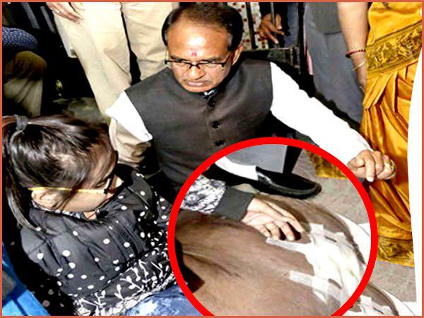 छात्रा की हालत देख भावुक हुए सीएम शिवराज छात्रा की हालत देख भावुक हुए सीएम शिवराज