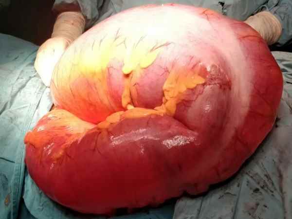 तबीयत बिगड़ी तो पता चला