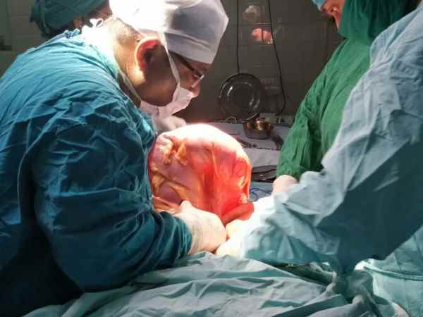 डॉक्टरों ने किया सफल ऑपरेशन