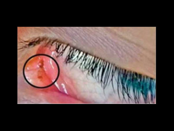  अब तक निकल चुकी हैं 60 चीटियां