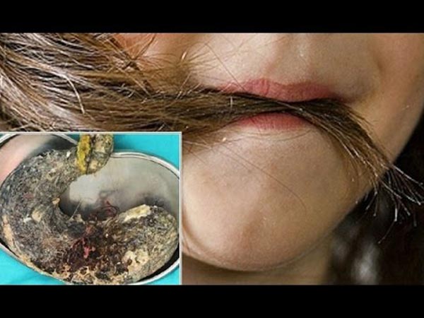 6 महीने से पेट में दर्द 