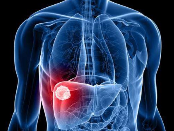 'एलएचपीपी हेल्दी टिशू में मौजूद है'