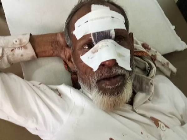 Two accidents in Kannuaj, many injured