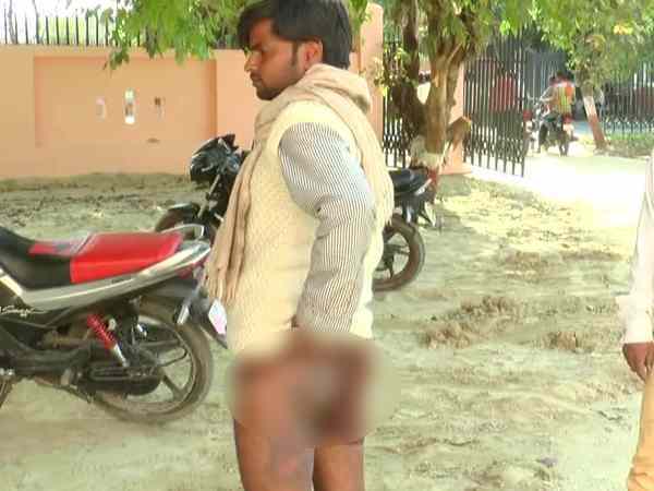 अब पुलिस कर रही है कार्रवाई की बात 
