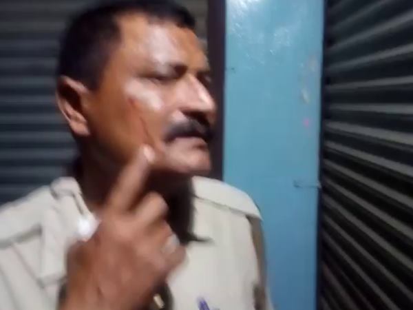 गाल और अंगूठे से निकाल दिया खून