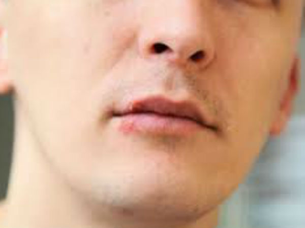 पतले होंठ