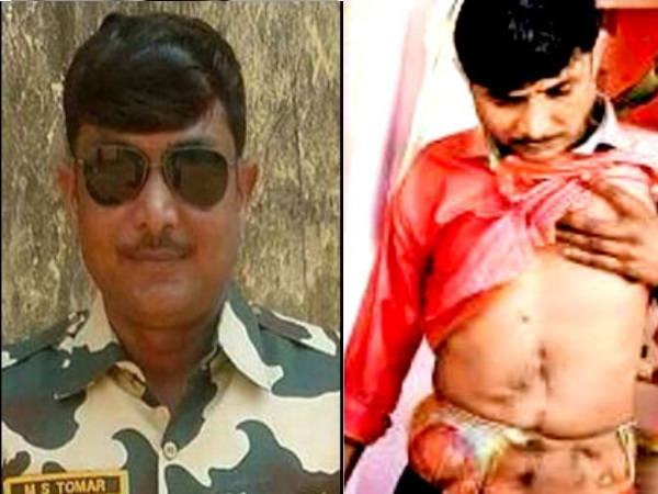 आंंत ही नहीं गोली लगाने से आंख भी हो गई खराब