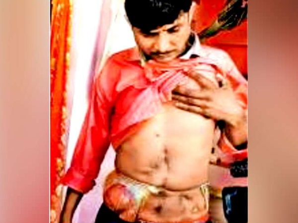 शिवराज सिंह ने दी 10 लाख रुपए की आर्थिक मदद