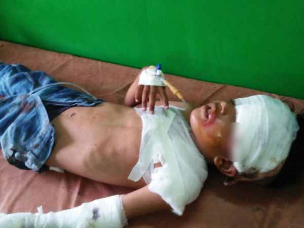 Police car collision, four injured in Mathura