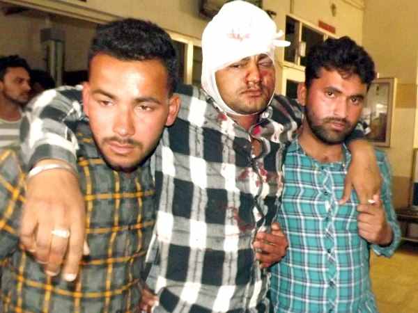 youth shot in Harsh firing in Sultanpur
