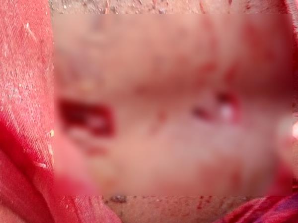 आरोपी की गिरफ्तारी में लगी पुलिस