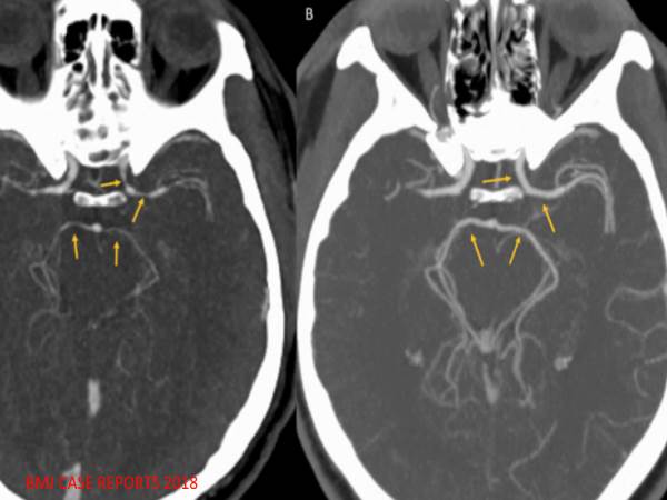 जब न्यूयॉर्क के इस शख्स के मुंह में लग गई आग जब न्यूयॉर्क के इस शख्स के मुंह में लग गई आग