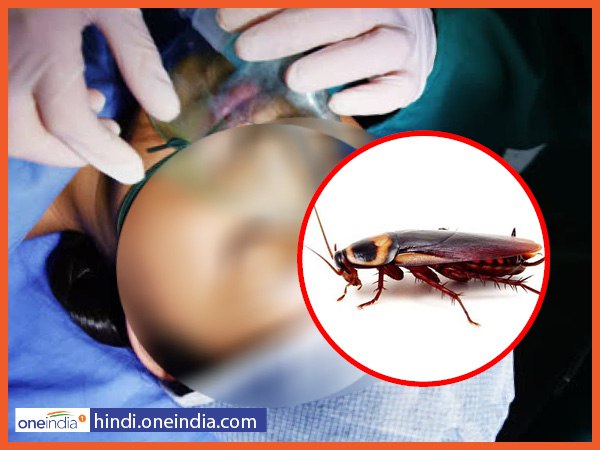 ऑक्सीजन पाइप में कॉक्रोच फंसा हुआ था