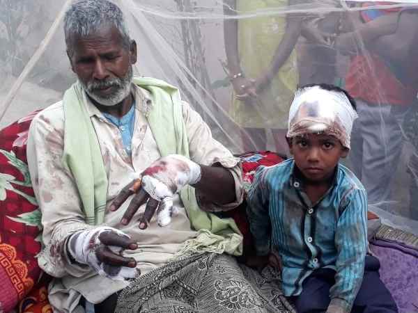 तेंदुए ने किया कमलनयन पर हमला