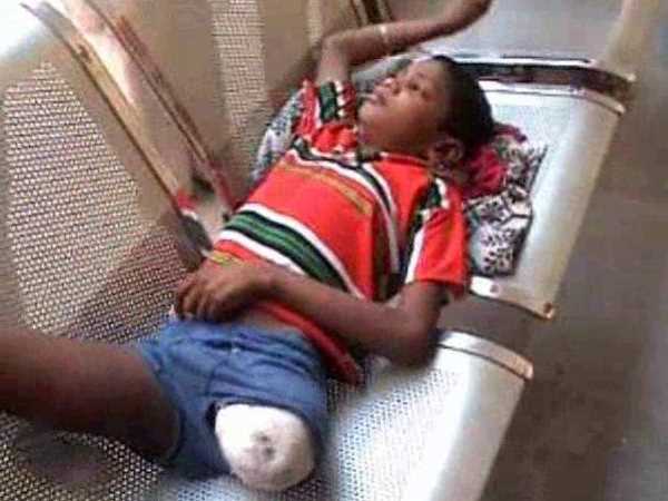A minor boy thrashed by cousin, engine cut the leg in Kannauj A minor boy thrashed by cousin, engine cut the leg in Kannauj