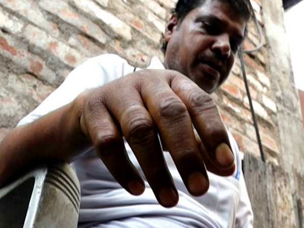 पूछताछ के दौरान पुलिस ने दी यातनाएं