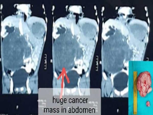  पांच घंटे चला ऑपरेशन