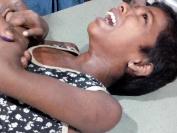 Three children died due to Measles in Bahraich