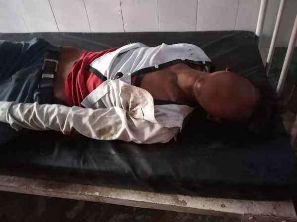 विशुनपुरा इलाके में हुआ हादसा विशुनपुरा इलाके में हुआ हादसा