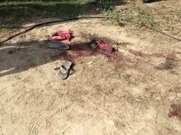 घायलों का चल रहा इलाज