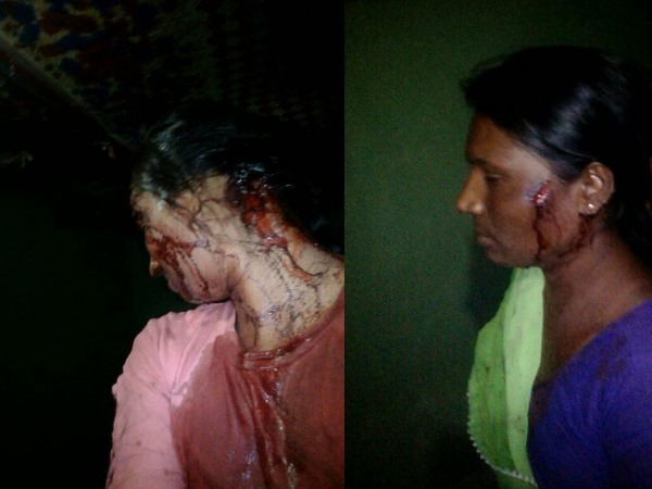 मां बचाई रुपाली की जान मां बचाई रुपाली की जान