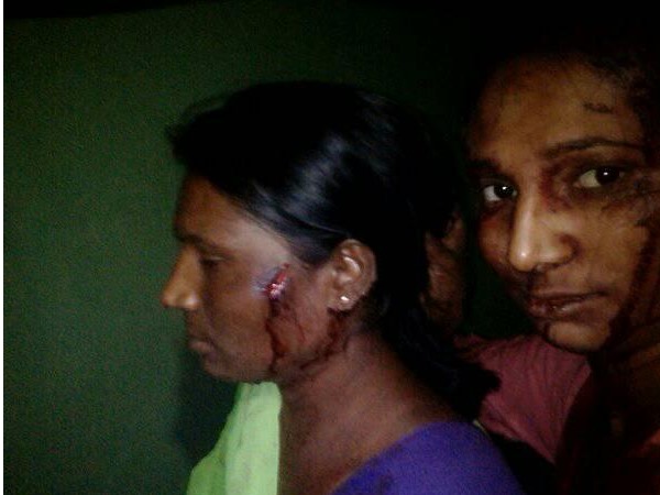 वन विभाग का दावा बाघ नहीं तेंदुए ने किया था हमला वन विभाग का दावा बाघ नहीं तेंदुए ने किया था हमला