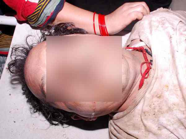 पांच कुंतल का भारी-भरकम कपलिंग पांच कुंतल का भारी-भरकम कपलिंग