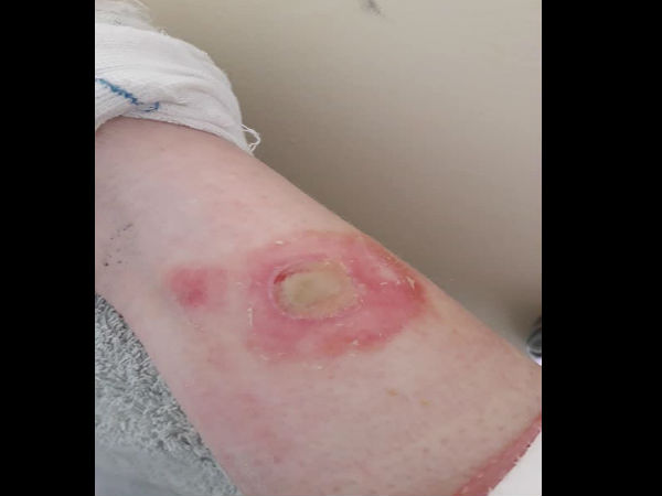 चैलेंज की वजह से गहरे जख्म