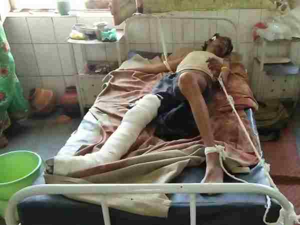 हाथों -पैरों को बांधकर होता है इलाज