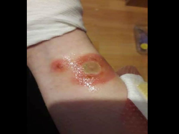 स्किन कैंसर जैसी घातक बीमारी का खतरा