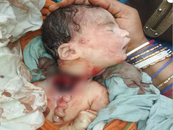 प्रसूता के देवर को पहले जमकर पीटा फिर पुलिस के हवाले कर दिया