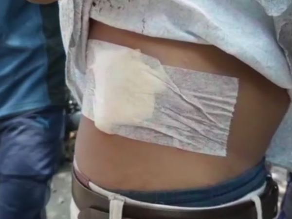 Clashes erupted Banaras Hindu University BHU student stabbed 