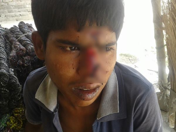 sambhal girls cut the nose of half mind boy who was molesting them sambhal girls cut the nose of half mind boy who was molesting them