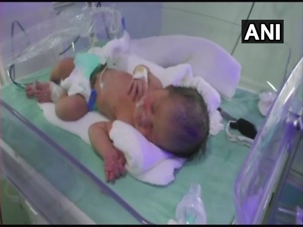 रोजा तोड़कर दिया बच्ची को दिया खून