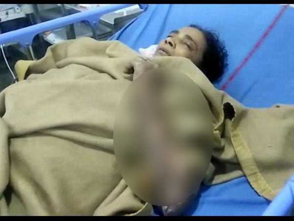 तेजाब और पेट्रोल डालकर जलाया तेजाब और पेट्रोल डालकर जलाया