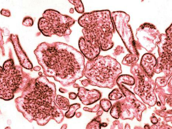  क्या है 'निपाह वायरस'