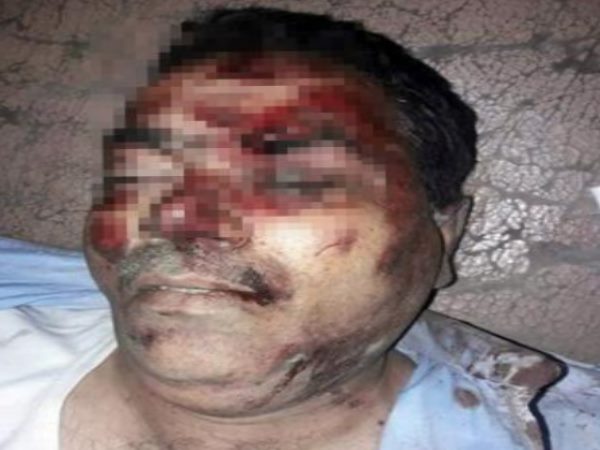 himachal pradesh doon former mlas brother killed by chopping his throat