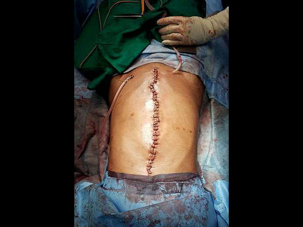 मिली नई जिदंगी मिली नई जिदंगी