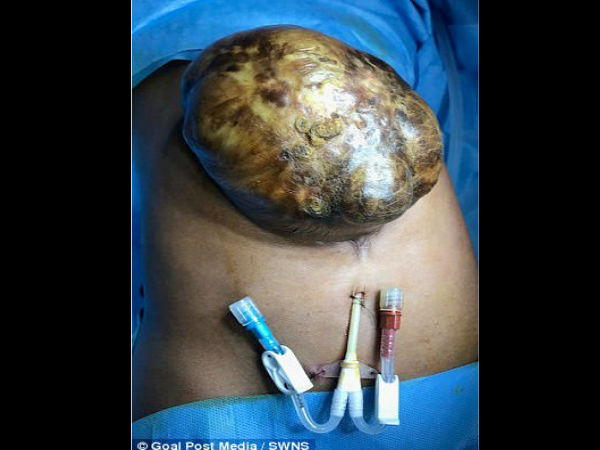 बीमारी की वजह से छूट गई पढ़ाई बीमारी की वजह से छूट गई पढ़ाई